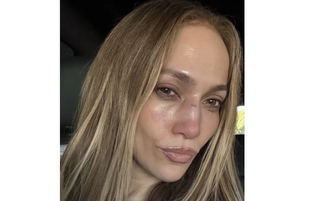 Jennifer Lopez comparte imágenes de su lesión tras caída en ensayo