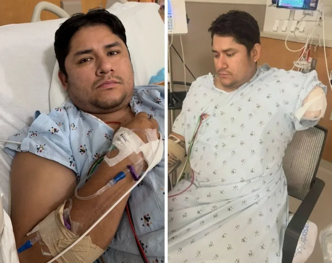 Grave herida en redada de ICE: mexicano pierde un brazo en California