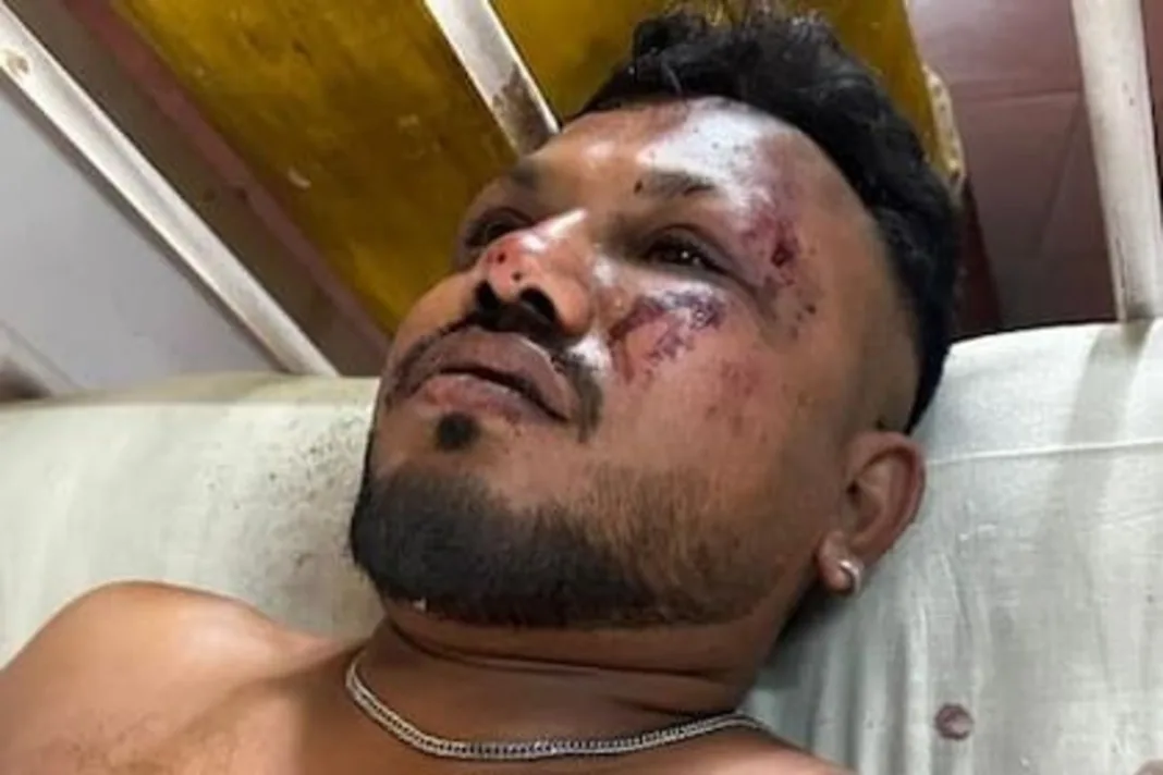Sobrevive un pasajero del accidente aéreo de Air India: ¿Qué se sabe de su estado?